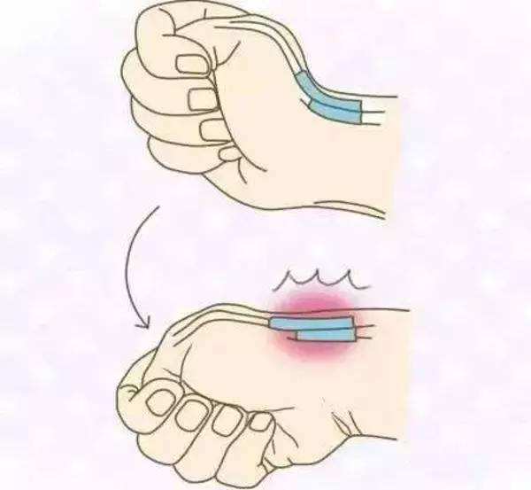 磁共振可以直接诊断椎间盘突出吗,颈椎椎间盘突出致使左臂疼痛