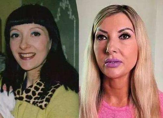 50岁女性整容后续,50岁女人突然整容