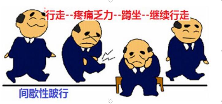 腰椎管狭窄为什么越走越痛,腰椎管狭窄压迫腿疼怎么锻炼有效