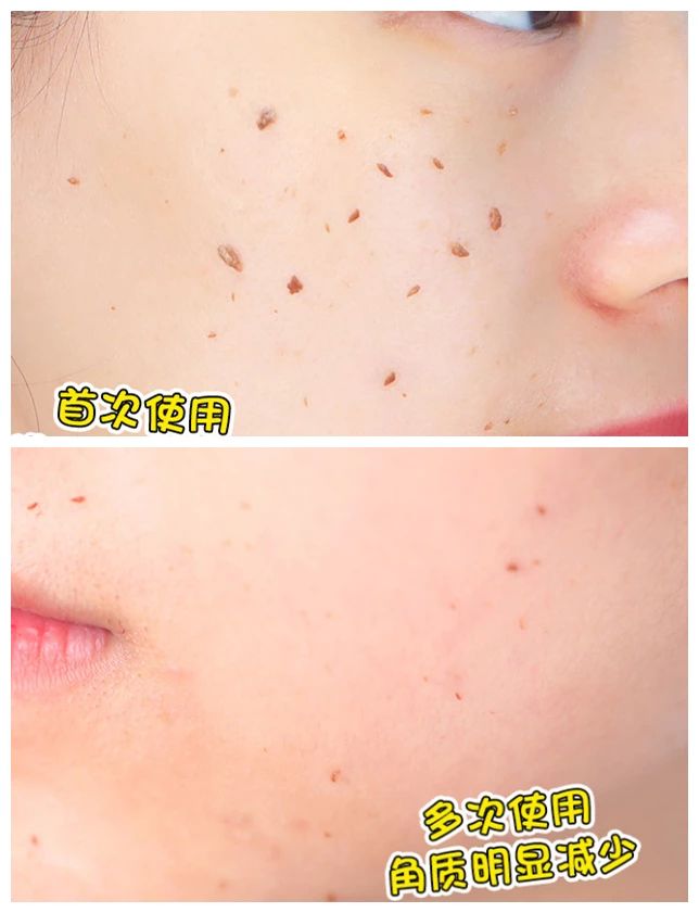 孙艺珍的颜值变化,孙艺珍颜值巅峰的笑容