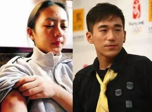 当年张默打童瑶的时候,张默打童瑶事件图片