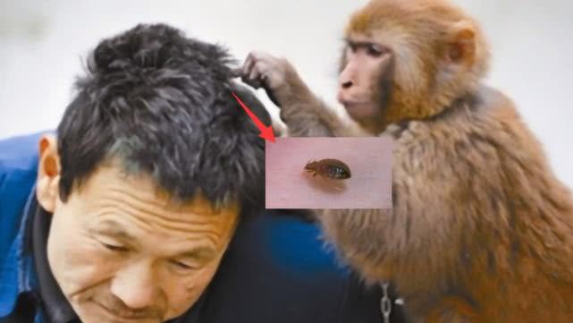 曾经人人都有的虱子，现大势已去但仍存在，这样的人容易感染虱子