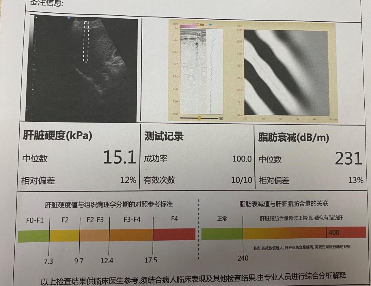 乙肝二十几年了会怎么样,乙肝二十多年了肝功能一直都正常