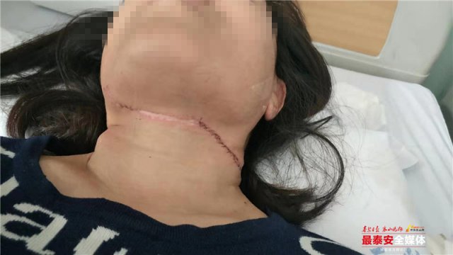 事发*安泰**!女子骑电动被风筝线割伤,割喉伤处缝补30多针