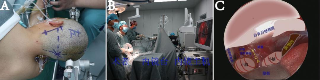 见微知著,内镜显神通