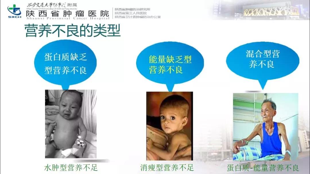 肿瘤营养治疗案例分享,肿瘤营养治疗最新进展