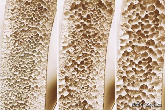 视频维生素d与心脑血管健康,维生素d缺乏能生健康宝贝吗