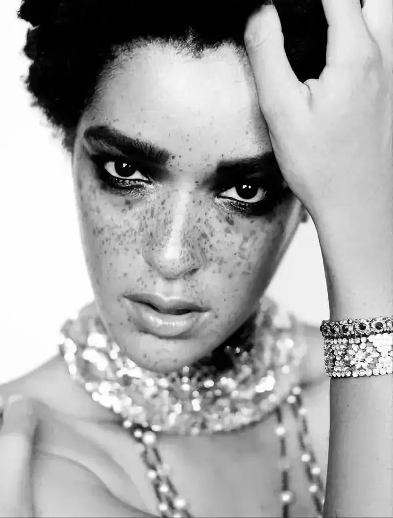 全身黑斑被骂“斑点狗”，身高160的她却成为最美超模…