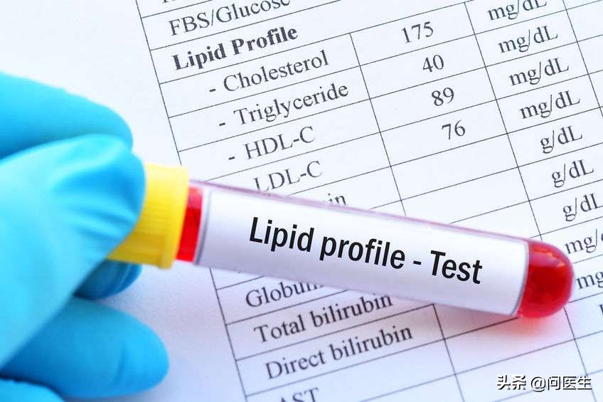 血脂胆固醇甘油三酯都高怎么办,血脂胆固醇甘油三酯高怎么调理