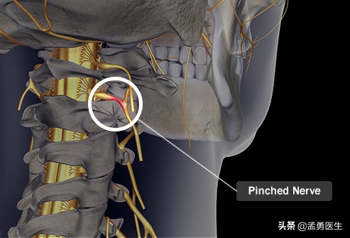 有时会出现不明原因的胸痛,可能引起胸痛的所有疾病