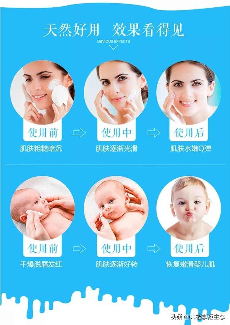 治疗湿疹,牛皮癣,婴儿孕妇都可以使用的面霜