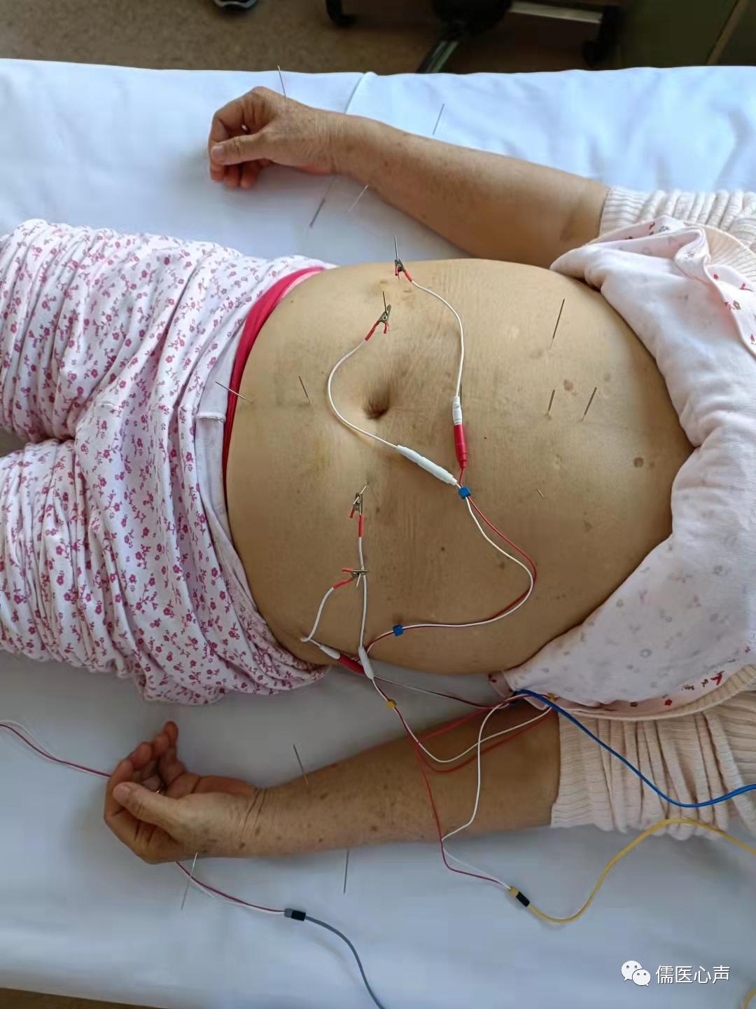 医生,全世界的病都长到我一个人身上了,我该怎么办?