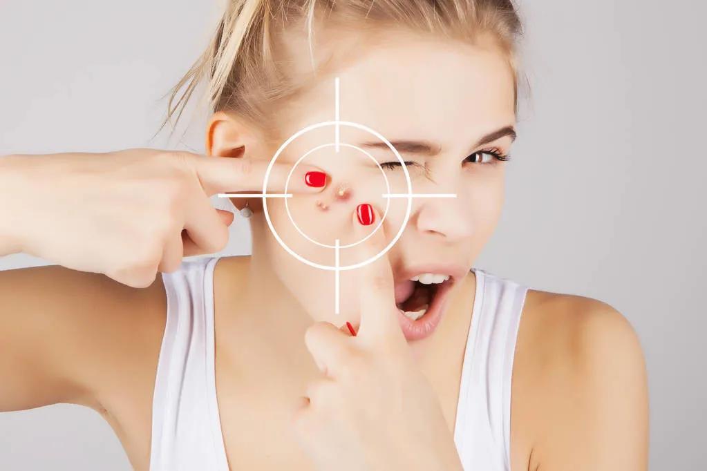 敷完面膜就长痘是敏感肌吗,敷中药面膜长痘是排毒吗