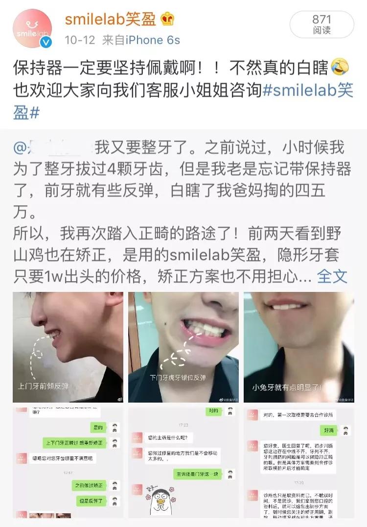 整牙后笑容会变好看吗,smilelab笑盈测评