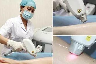 毛发脱毛,哪种脱毛才是永久性脱毛