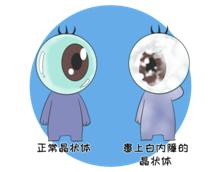 眼科免费义诊通知,眼科医院义诊