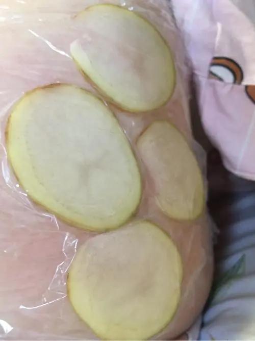 打完疫苗贴土豆片,打疫苗的地方疼可以贴土豆片吗