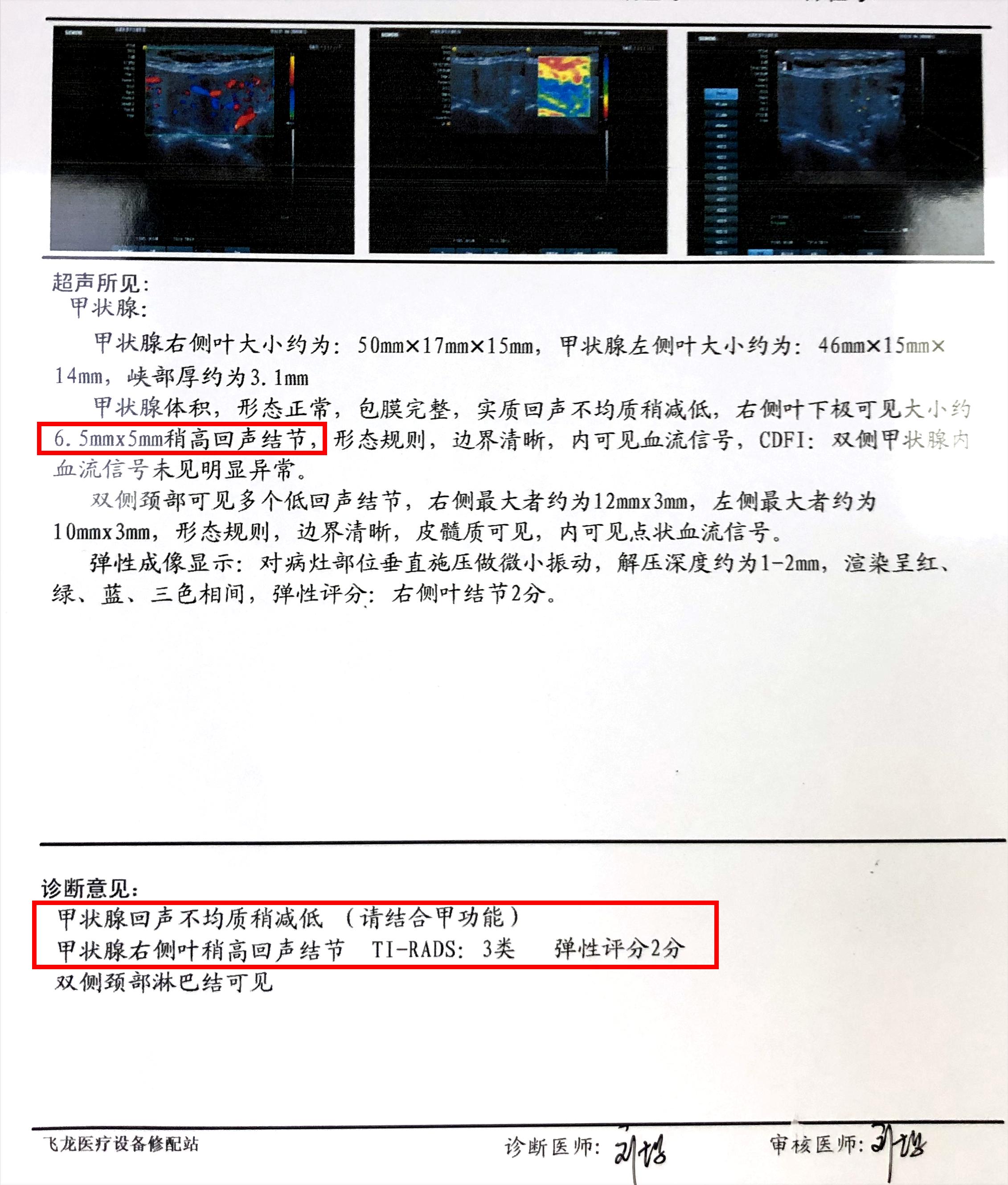 甲功八项全部异常,桥本氏病甲功五项哪项异常