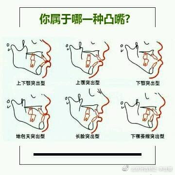 怎样判断龅牙是牙性还是骨性,怎么判断是牙性龅牙还是骨性龅牙