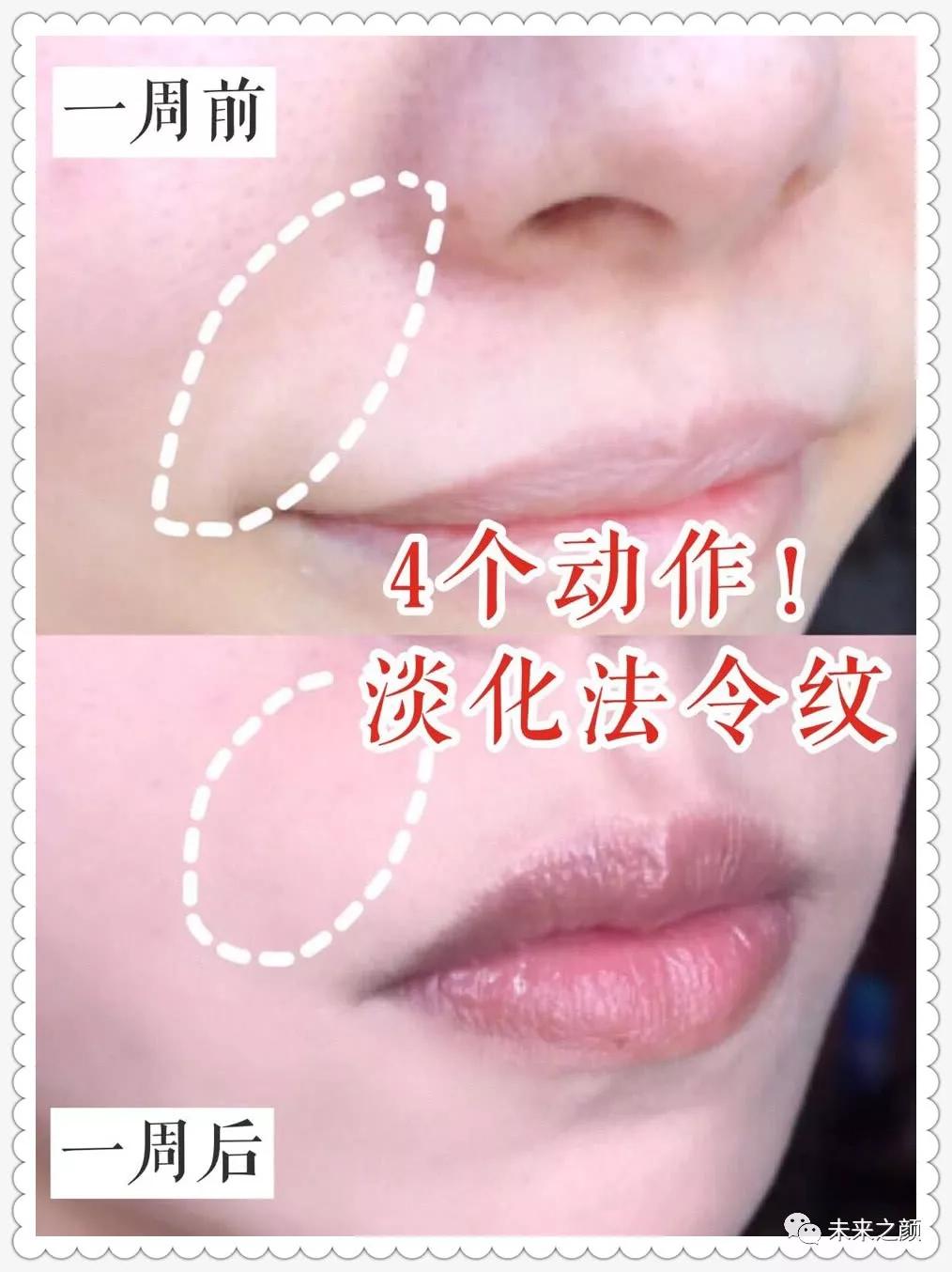 脸部做什么操祛除法令纹,面部瑜伽操改善法令纹抖音小游戏