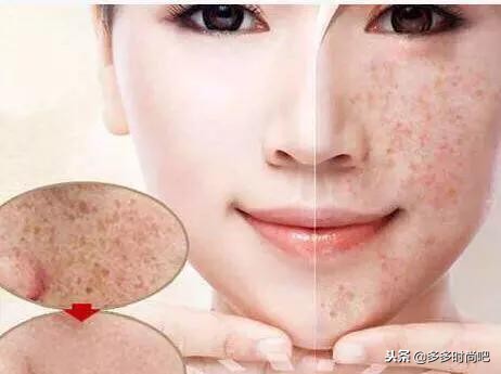 五个方法判断是否为“毒面膜”，铅汞超标会烂脸，别总舍不得丢掉