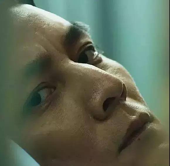 根治黑头的最佳方法,怎么才能彻底治好黑头