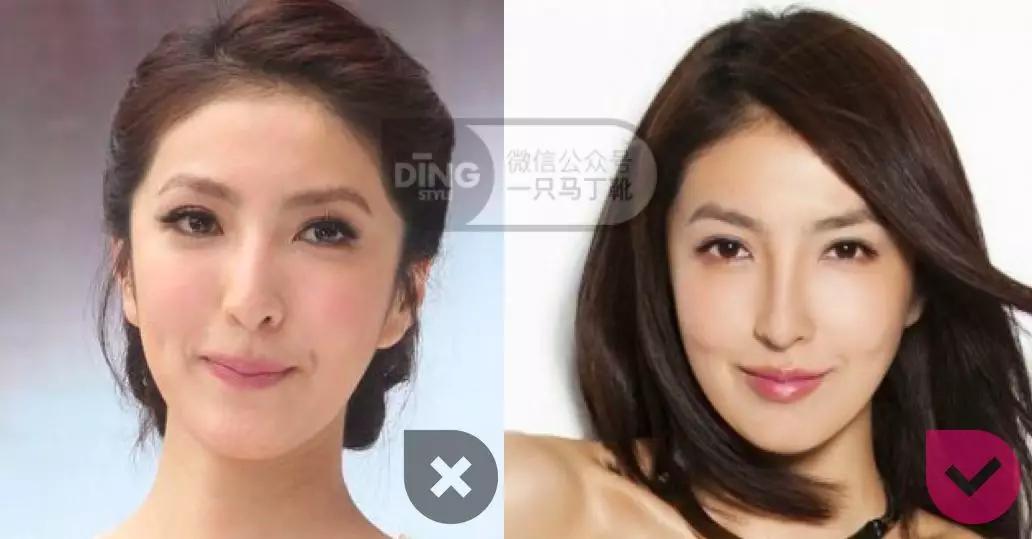 颧弓高脸型怎么改善,有泪沟可以通过调整脸型改善嘛