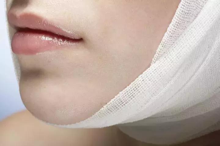 杭州38岁副教授决定锯掉下巴！睡觉一个习惯，让他长了一张“鸟嘴”