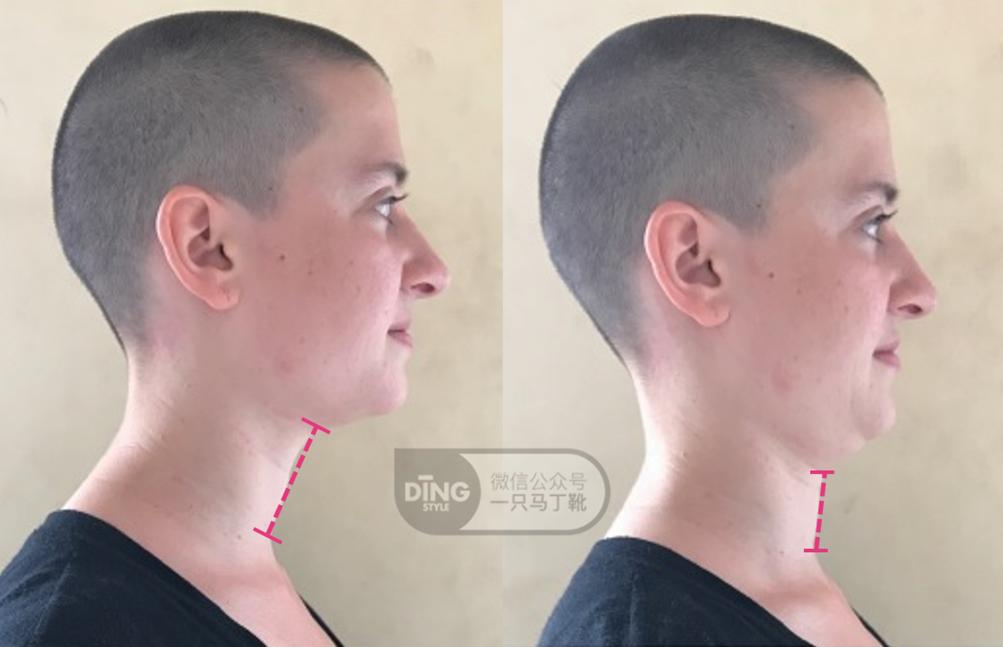 有效改善体态,提升气质减肥瘦全身方法