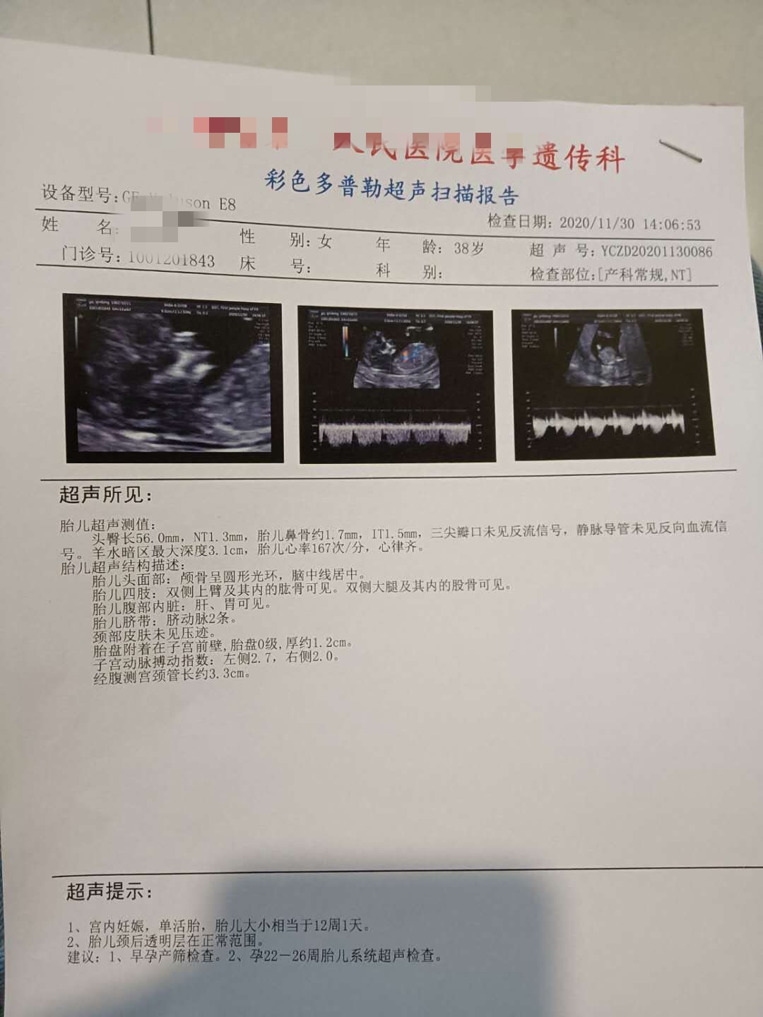 我整个孕检碰到的一些问题给孕妈们整理一下