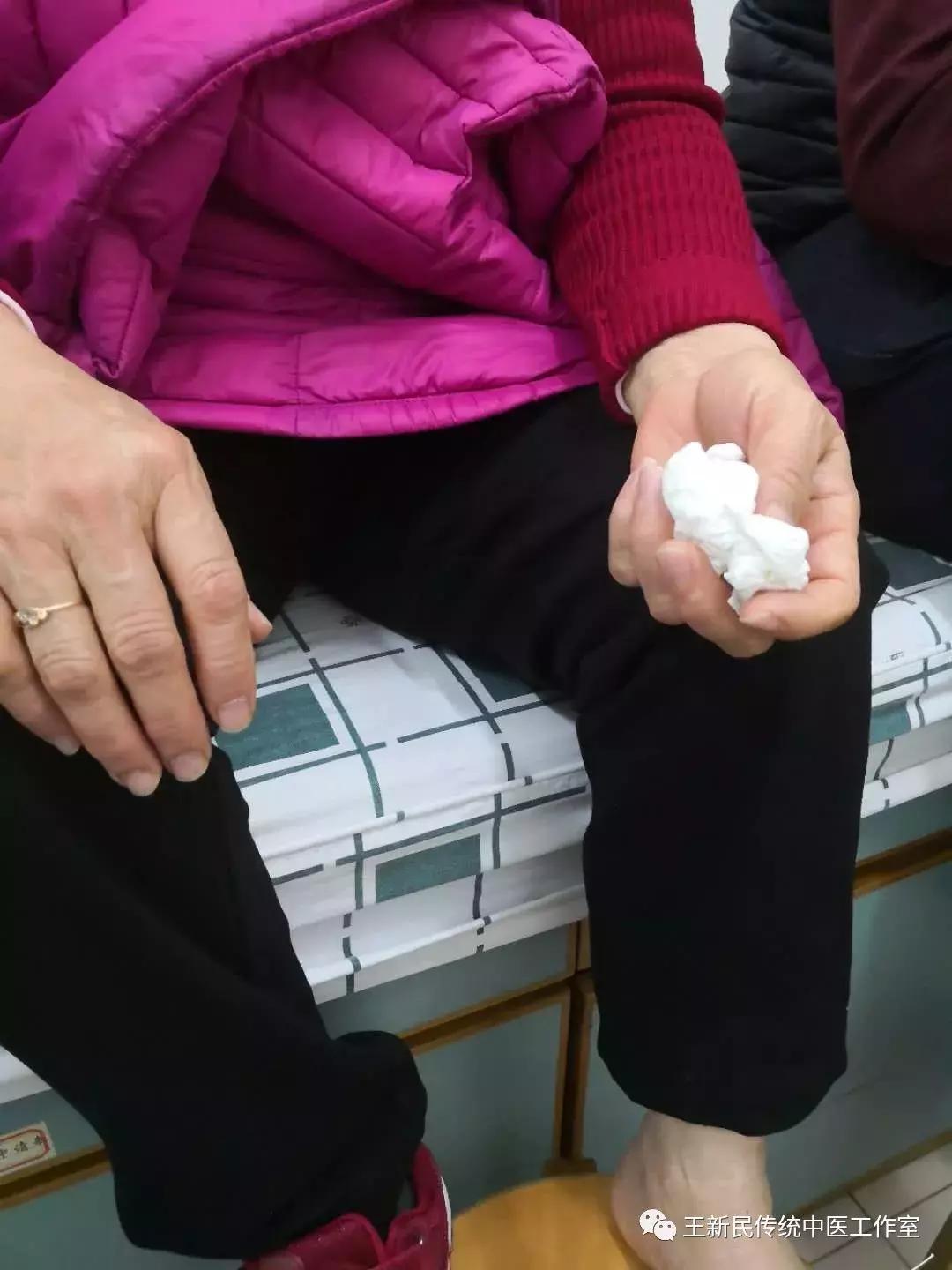 中医院王新民医术,王新民省中医院