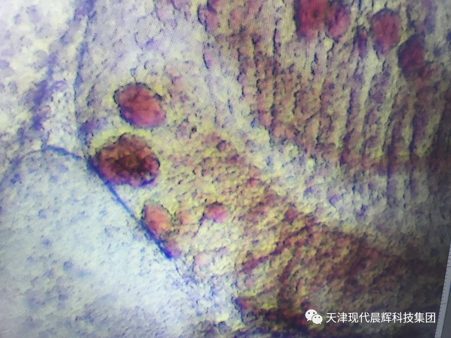 观赏鱼真菌病和细菌病的区别,观赏鱼真菌的症状