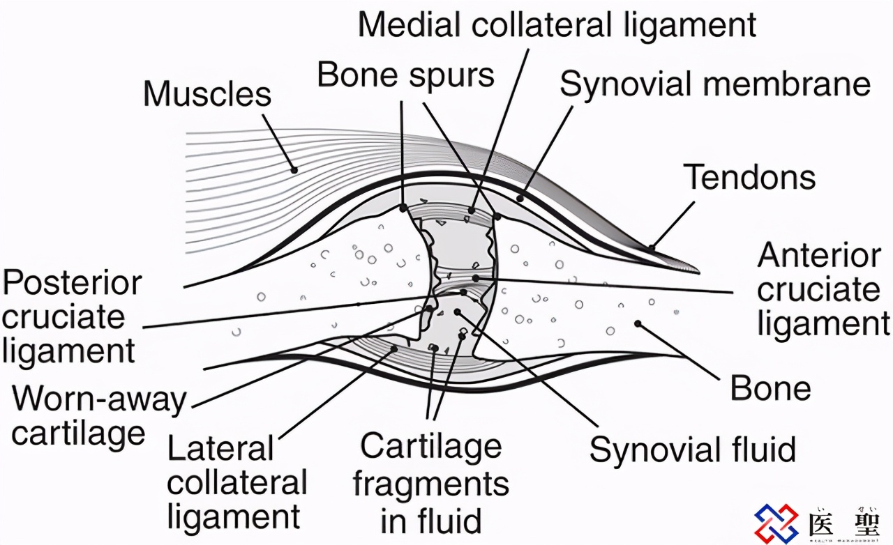 日本足协与再生法人机构签订再生医疗支援协议，修复球员运动损伤