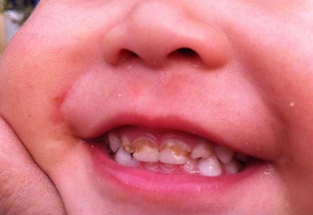 宝宝戒奶不接受奶瓶有何妙招,宝宝戒奶不接受奶粉怎么办