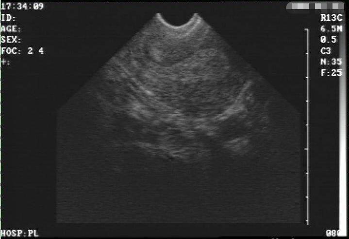 第一次产检确定是否怀孕注意事项,第一次产检需要查什么