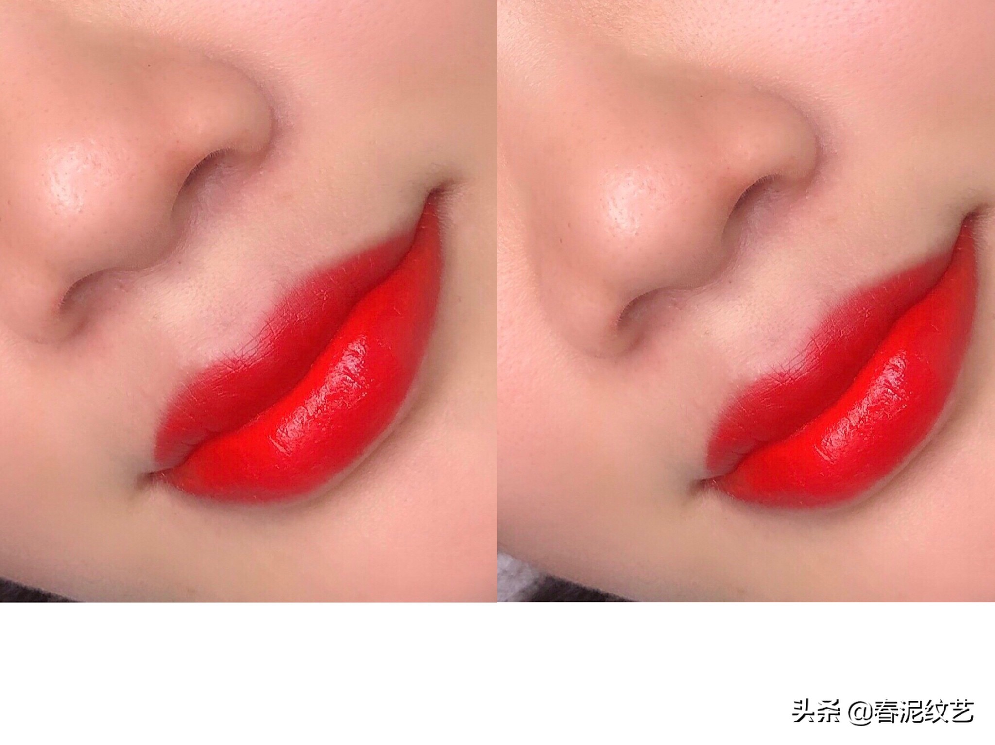 顾客纹唇后不忌口,起泡了怎么办?