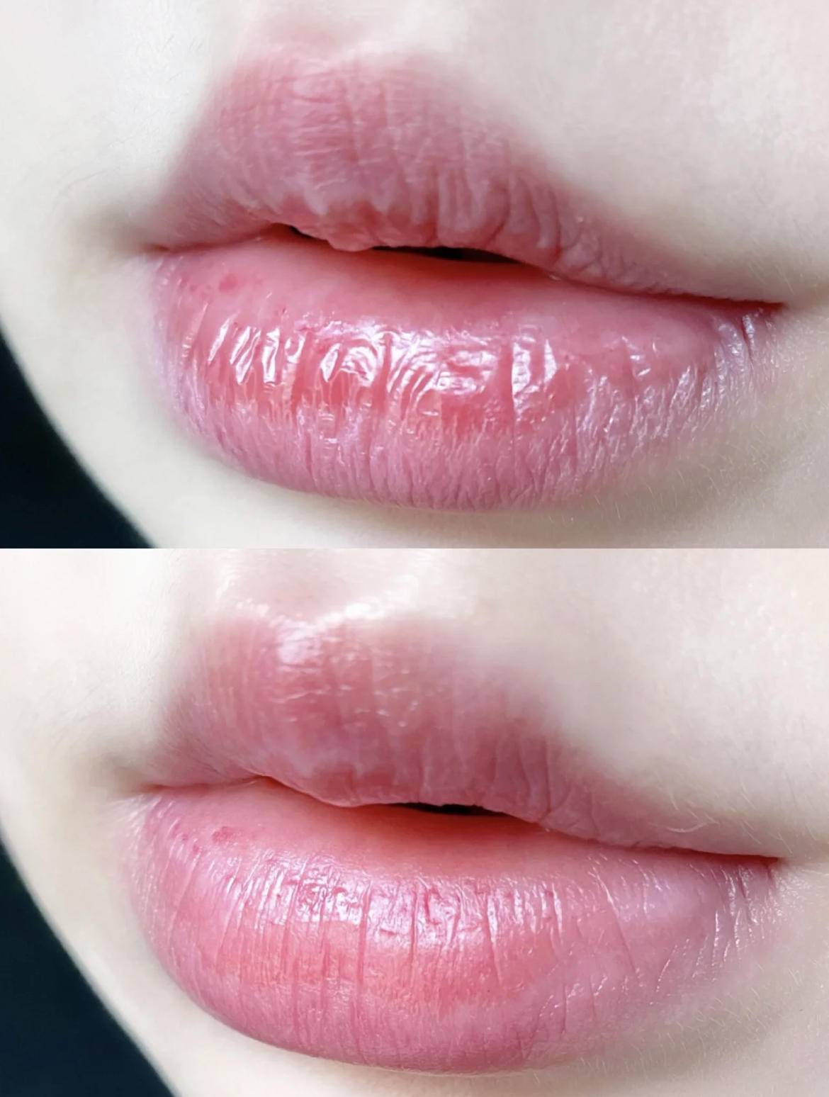 模特人像拍摄方法,模特拍摄前消肿