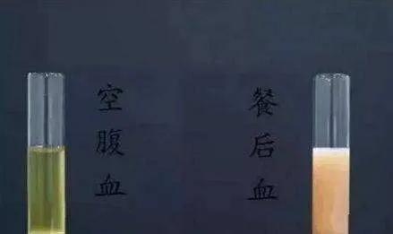 这就是空腹拍片的原因！听医生的话别让他受伤......