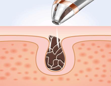 一些注射了玻尿酸的女人,那些做医美的女人最后怎么样了