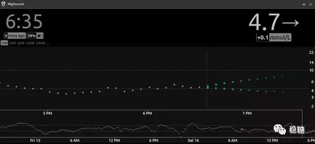 闭环式胰岛素泵会低血糖吗,闭环胰岛素泵使用寿命
