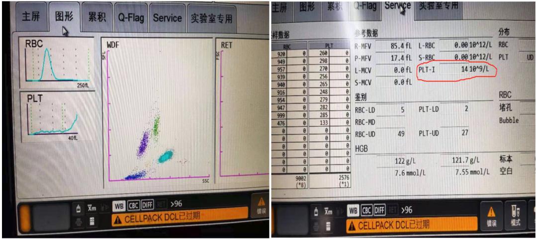 是谁揭开了血小板减少的面纱?