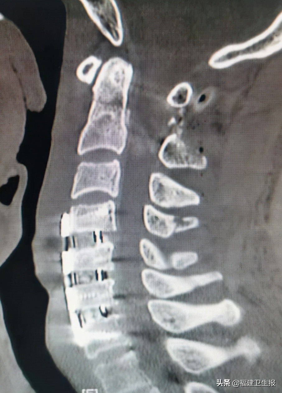 娉夊窞绗竴鍖婚櫌棰堟鎵嬫湳,娉夊窞鍖婚櫌棰堟寰垱