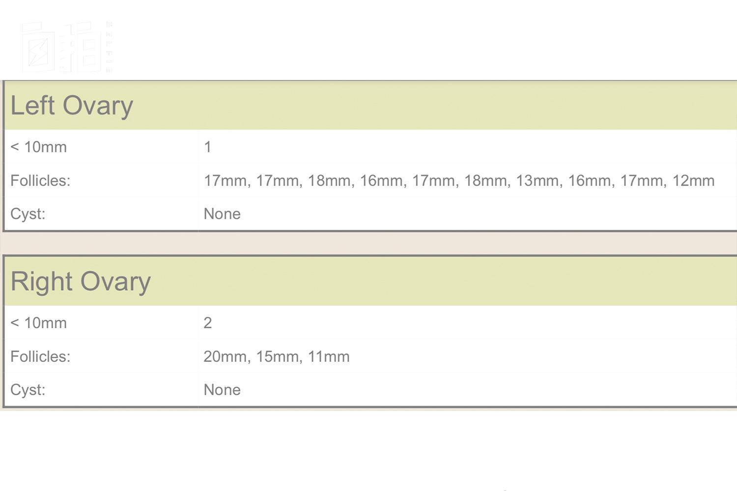单身女性可以冷冻卵子吗,百万年薪女子冻卵纪录片