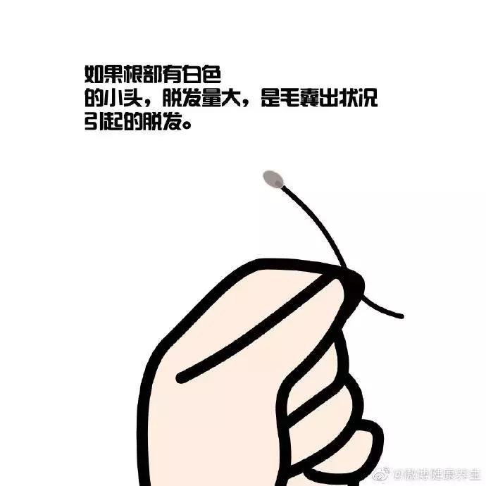 我国超2.5人脱发,中国有多少人脱发