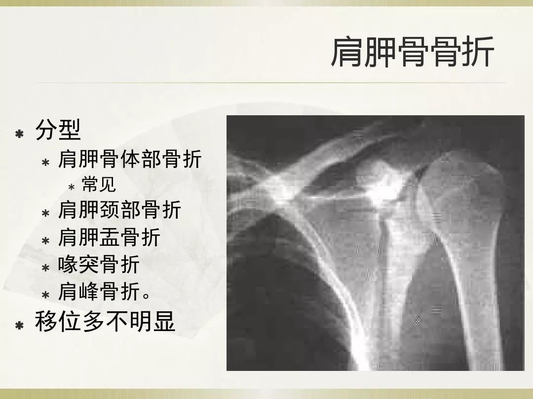 骨科x光片读片技巧,放射科骨科读片教程