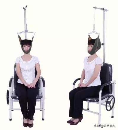 颈椎病10种保守治疗方法建议转载,严重的颈椎病如何保守治疗