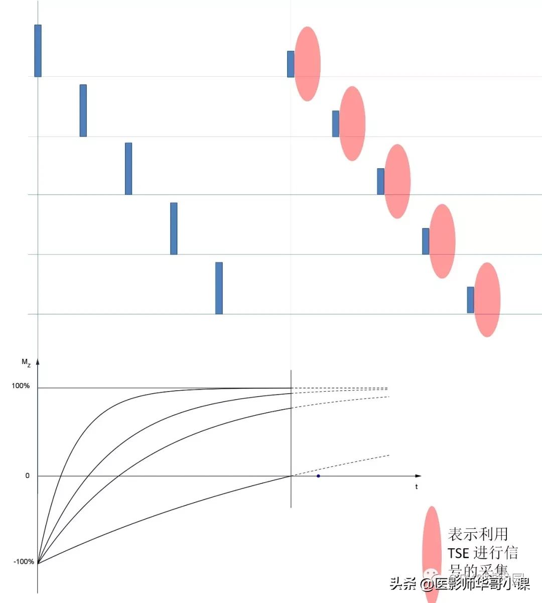 「MRI技术」磁共振伪影分析，了解下SSh_FLAIR序列