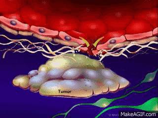 直肠癌用靶向药好还是普通化疗药,直肠癌靶向药和化疗哪种效果好