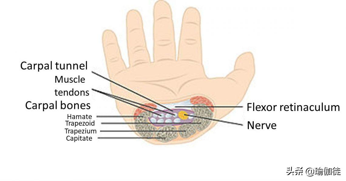 腕隧道征,腕道症候群怎么治疗
