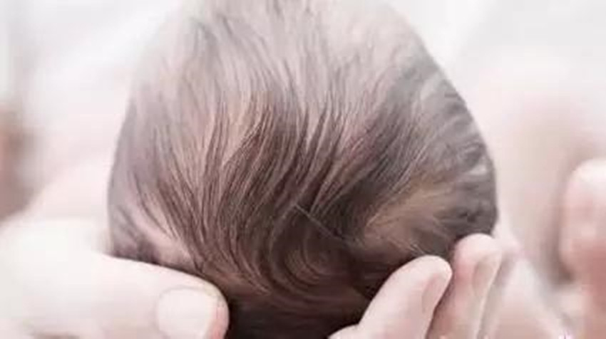 宝宝骨关节活动有响声,宝宝左侧额骨骨折怎么办